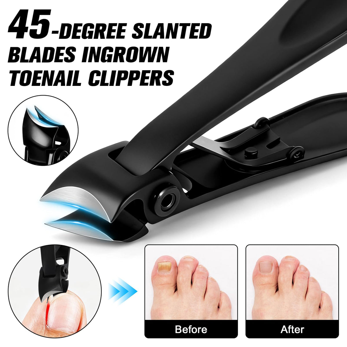 45-degree ingrown nail clipper from Redriver