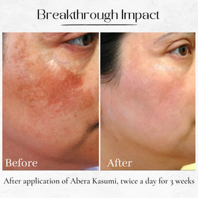 ABERA Kasumi Glowing Cream application on skin