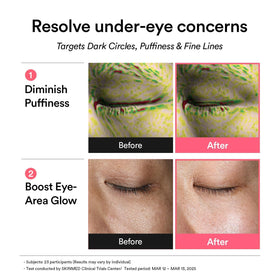 Abib PDRN Retinal Eye Patches with ingredients list