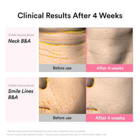 Abib PDRN Volume Fill-It support Cream with other serums