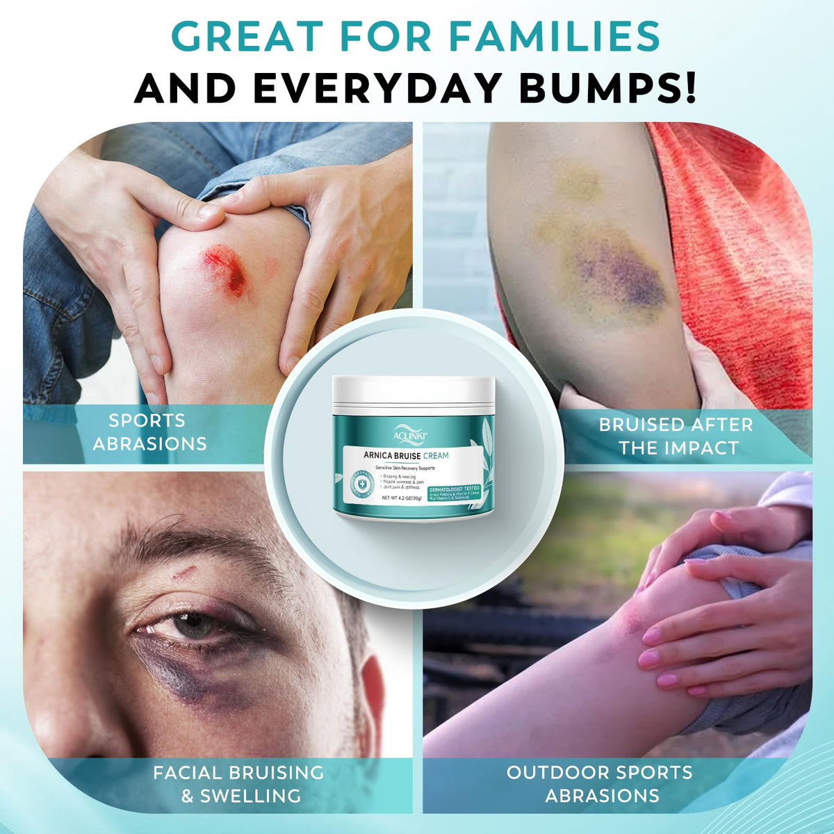 ACLINKI Arnica Bruise Cream application on skin