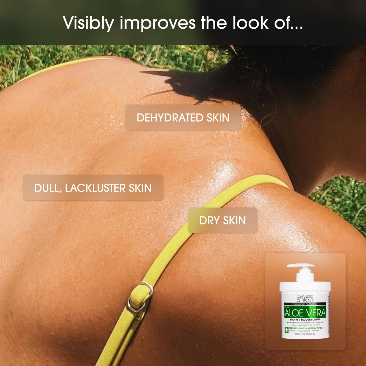 Advanced Clinicals Aloe Vera Lotion application on skin