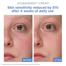 AESTURA ATOBARRIER365 Cream with ceramide capsules