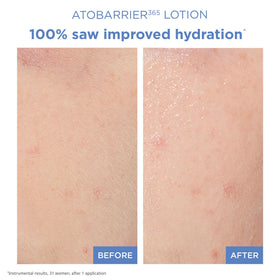 AESTURA ATOBARRIER365 Face Moisturizer application on skin