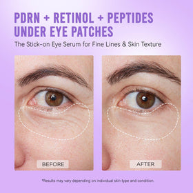 AILEORY PDRN Retinol Peptides Under Eye Patches showing texture