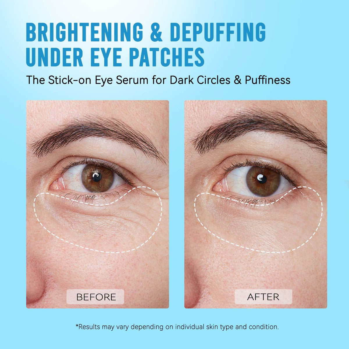 AILEORY Under Eye Patches displayed with skincare products