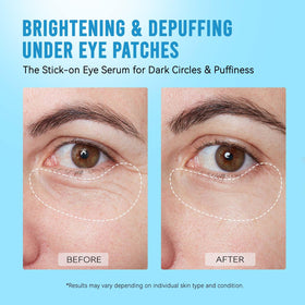 AILEORY Under Eye Patches displayed with skincare products
