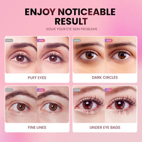 AILEORY Under Eye Patches showing tri-color design