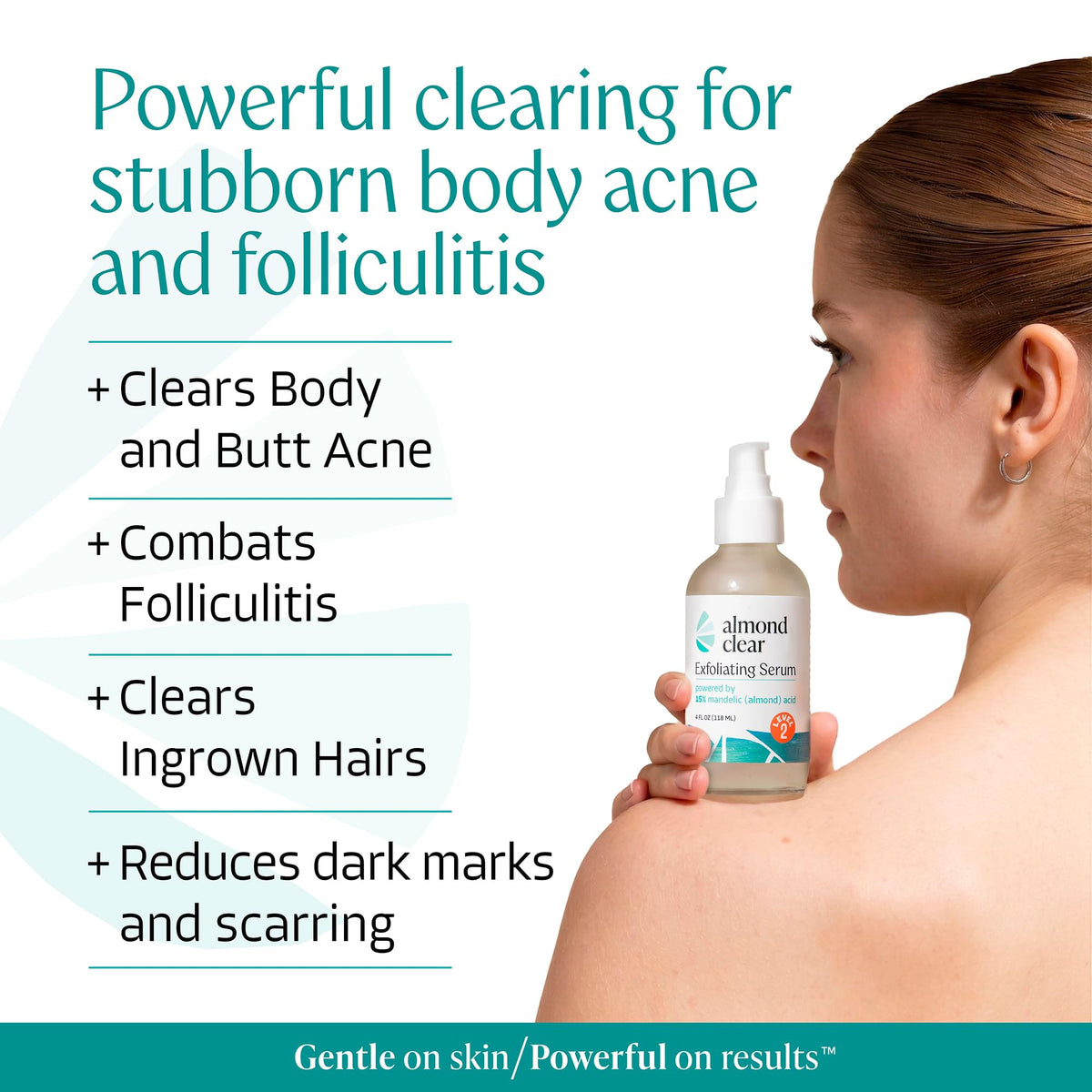 Almond Clear Mandelic Acid Level 2 Serum bottle with label