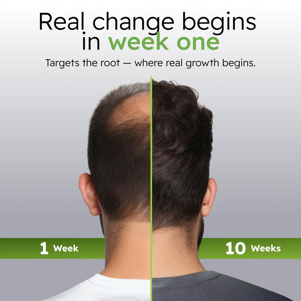 Alphainfuse Hair Serum for Men application on scalp