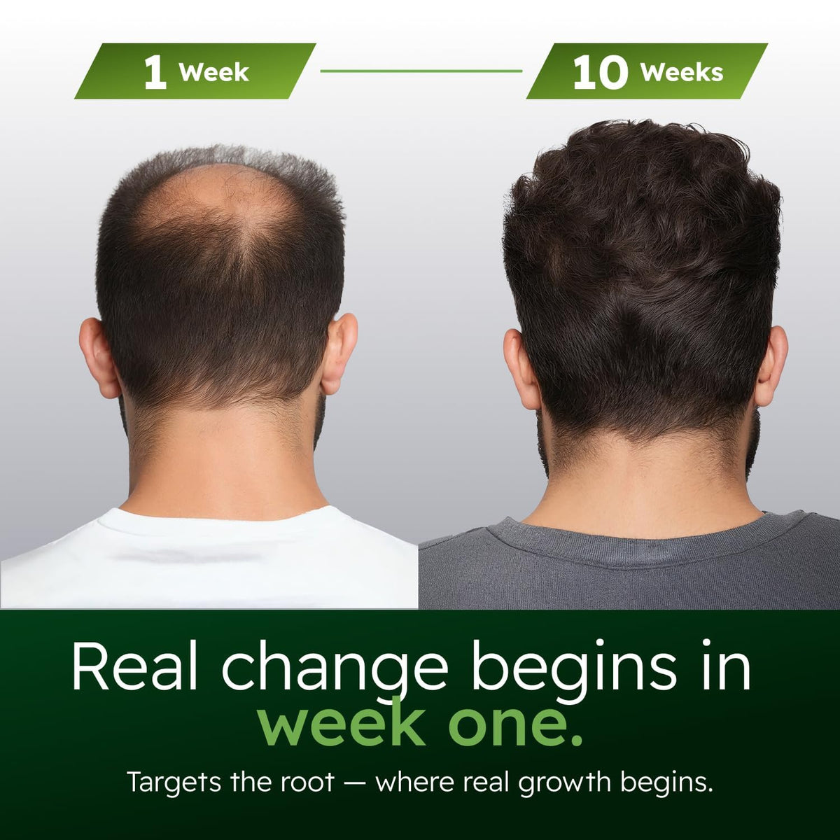 Alphainfuse Hair Serum for Men close-up of ingredients