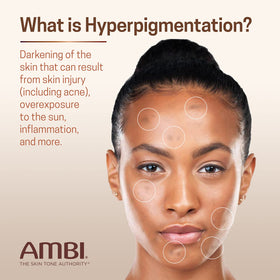 Ambi Even & Clear Fade Cream texture on hand