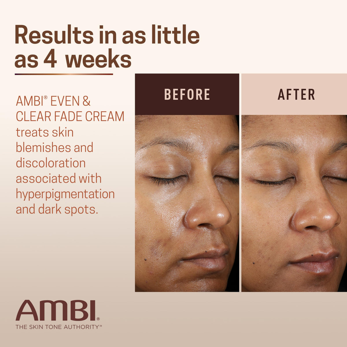 Ambi Even & Clear Fade Cream with Aloe Vera and Vitamin C