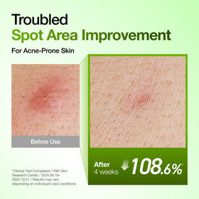 ANUA Azelaic Acid Serum application on skin