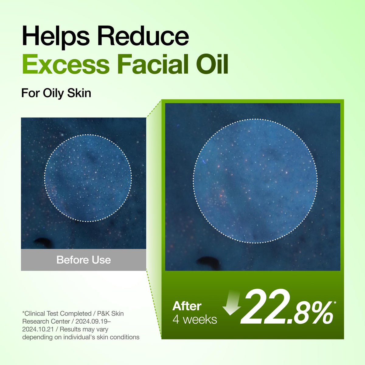ANUA Azelaic Acid Serum in a skincare routine