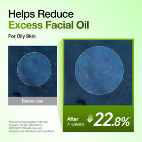 ANUA Azelaic Acid Serum in a skincare routine