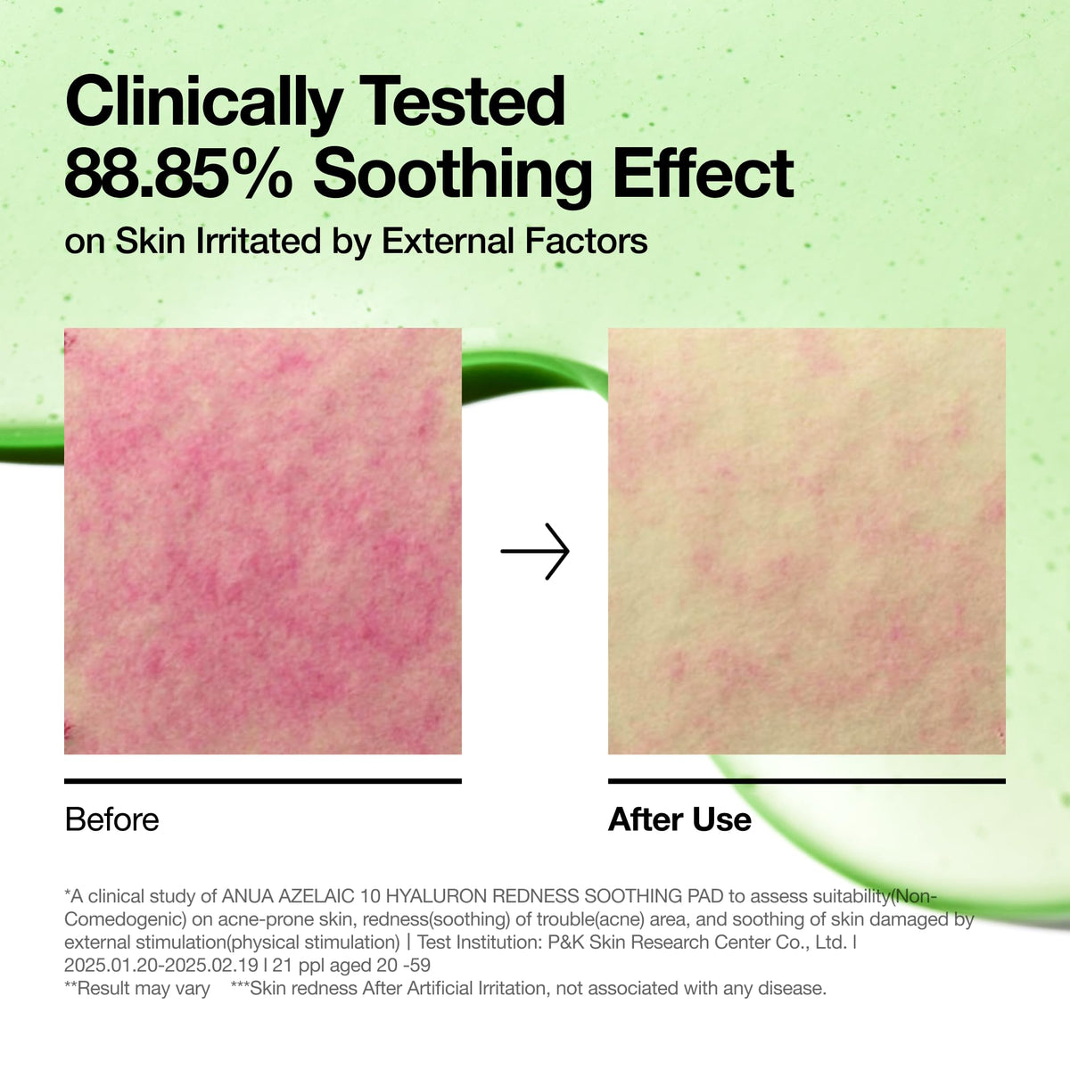 ANUA Azelaic Acid Toner Pads with serum for skincare routine