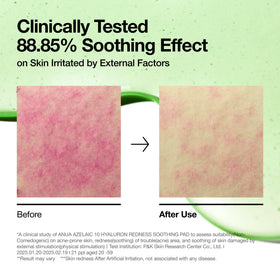 ANUA Azelaic Acid Toner Pads with serum for skincare routine
