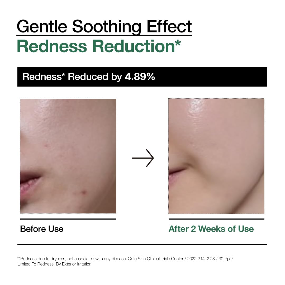 ANUA Heartleaf 80 Soothing Ampoule texture on skin