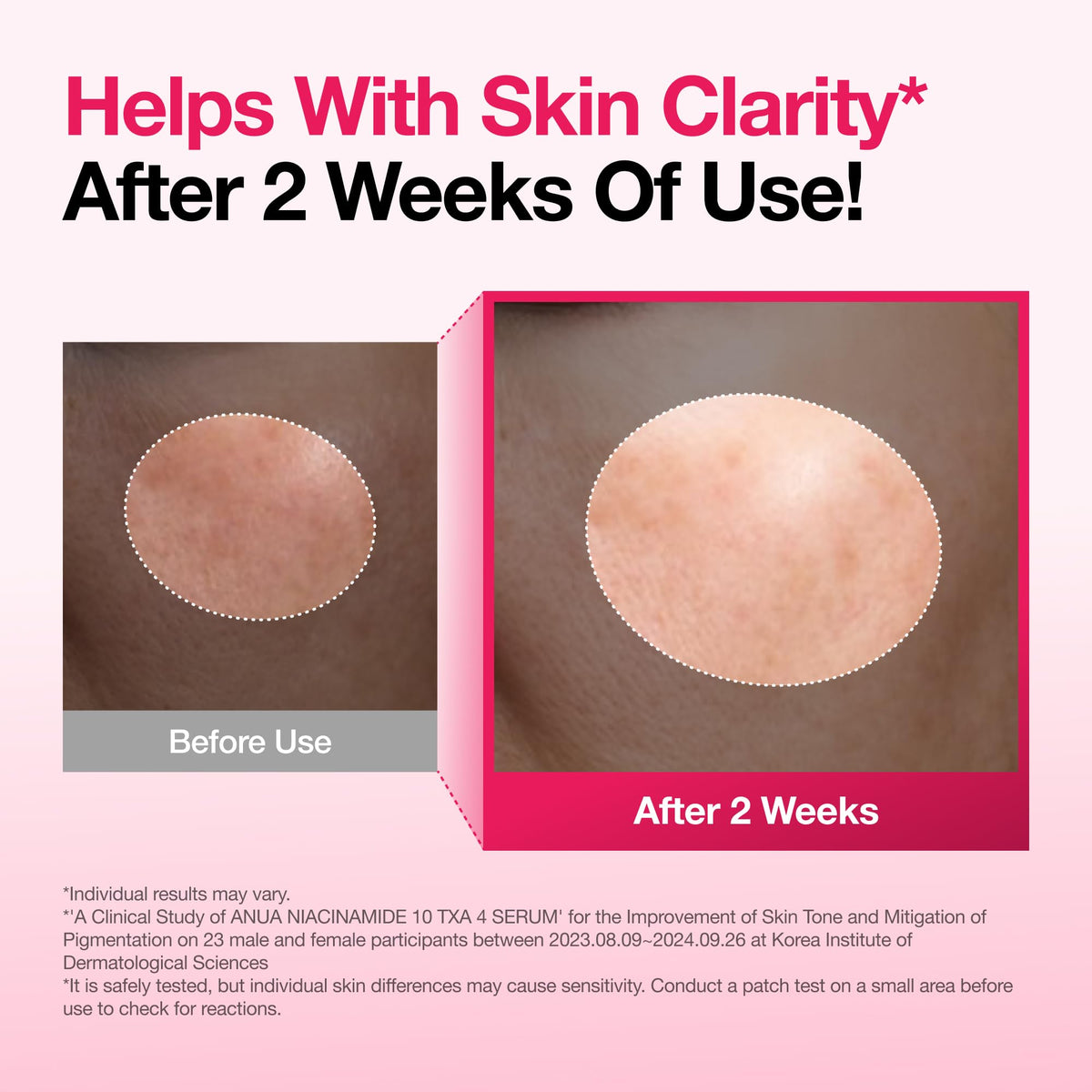 ANUA Niacinamide 10 + TXA 4 Serum with skincare products background