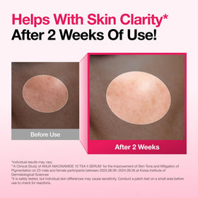 ANUA Niacinamide 10 + TXA 4 Serum with skincare products background