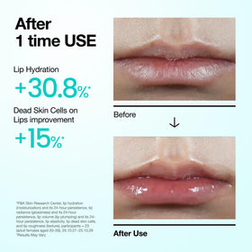 ANUA PDRN Lip Serum 0.33 fl.oz application on lips