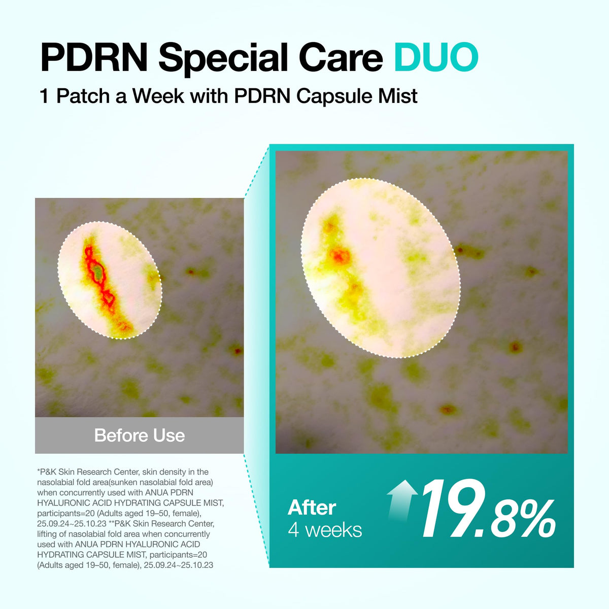 ANUA Salmon DNA PDRN Collagen Melting Patch in use on smiling face