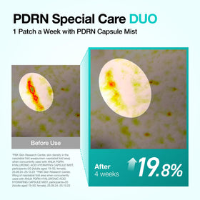 ANUA Salmon DNA PDRN Collagen Melting Patch in use on smiling face
