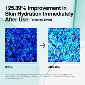 ANUA toner pads showing textured side for exfoliation