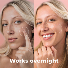 Application of PatchRx Micro Needle Pimple Patch on skin