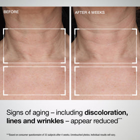 Application of StriVectin TL Advanced Tightening Neck & Chest Lotion SPF 35 on skin