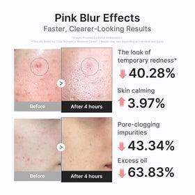 applying medicube 3H Overnight Drying Lotion with a cotton swab