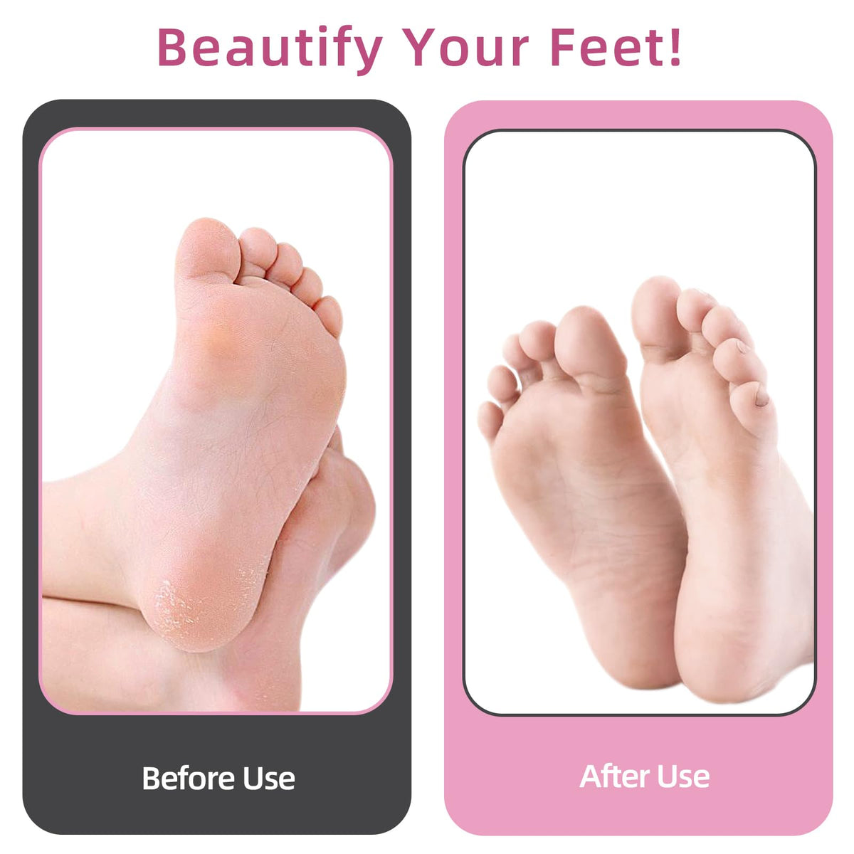 APRELM Electric Foot Callus Remover in use on feet