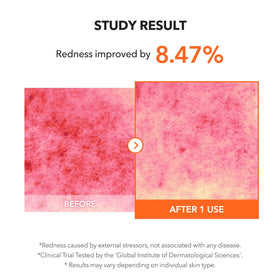 APRILSKIN Carrotene IPMP Clearing Solution 32g in use