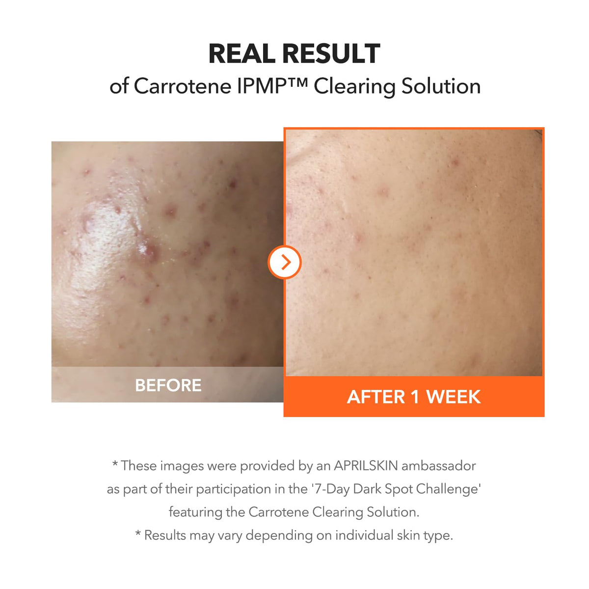 APRILSKIN Carrotene IPMP Clearing Solution 32g ingredients list