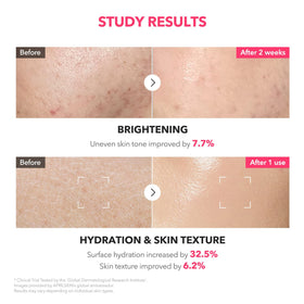 APRILSKIN TXA Niacinamide Pink Milky Toner in lifestyle setting