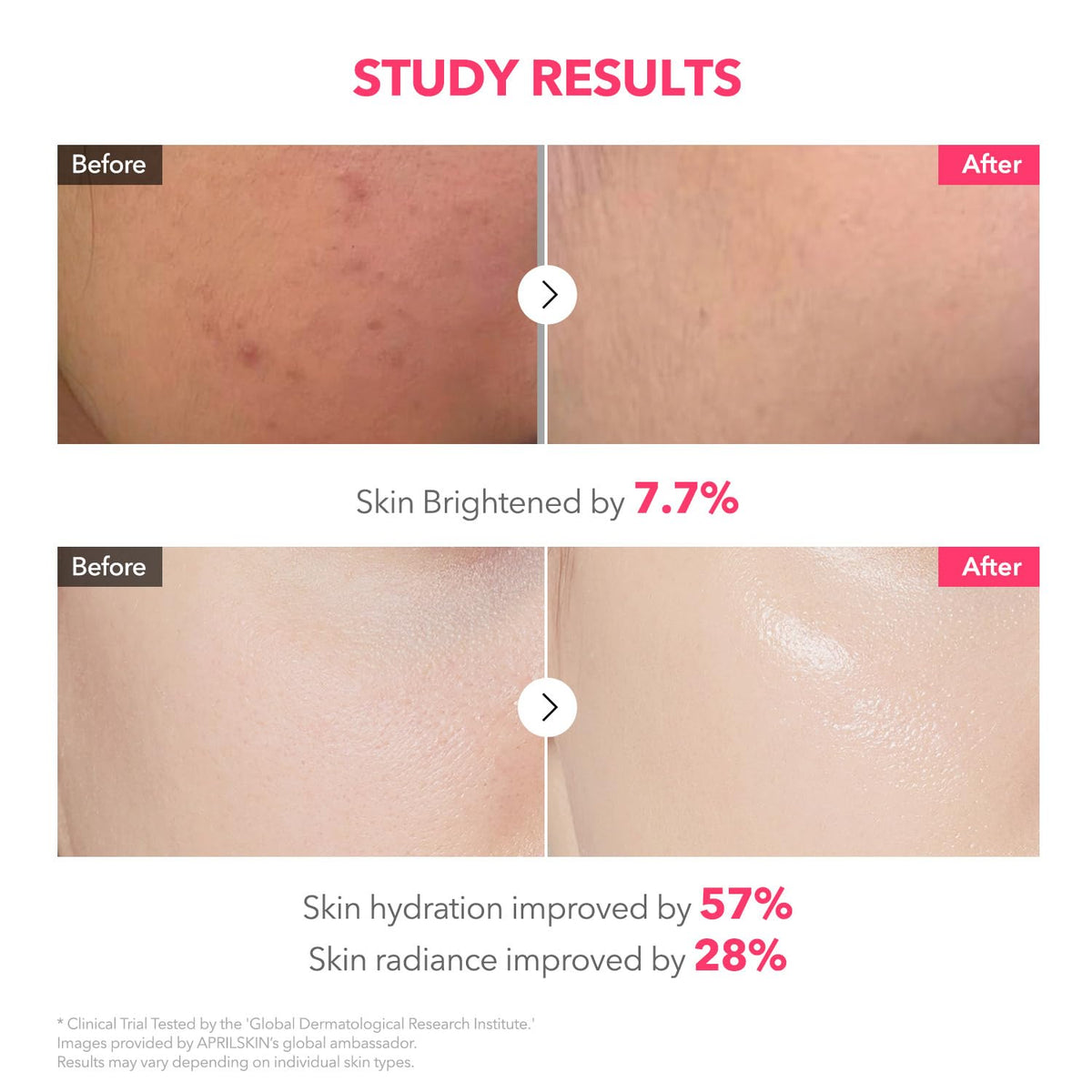 APRILSKIN TXA Pink Capsule Gel Mask capsules close-up