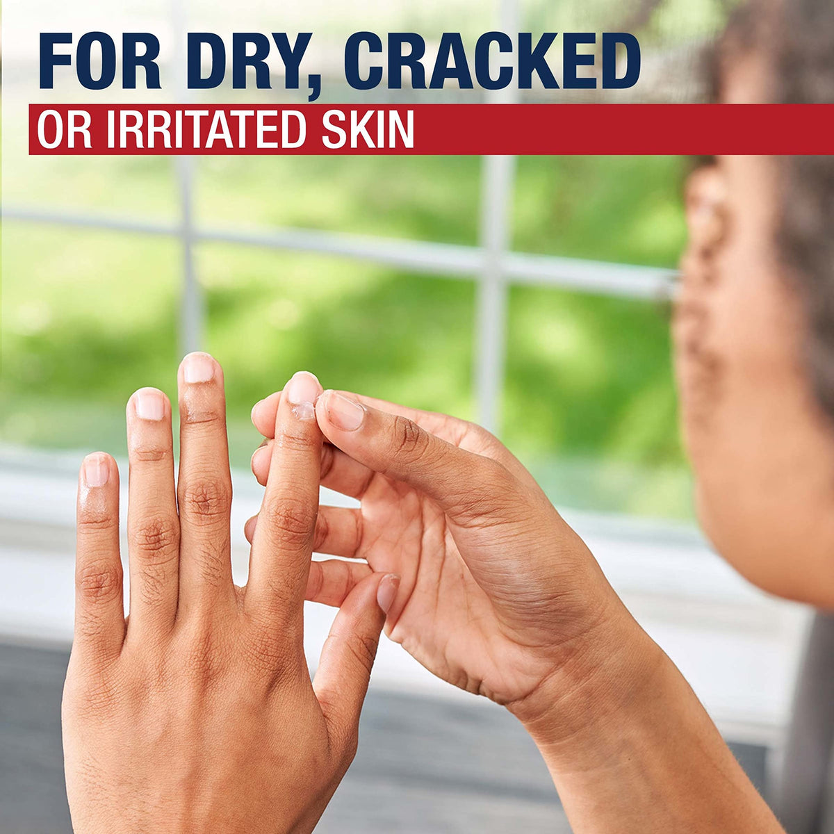 Aquaphor Healing Ointment applied on dry hands