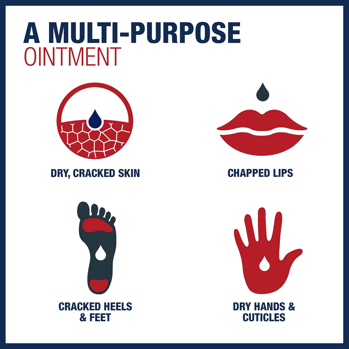 Aquaphor Healing Ointment for chapped lips