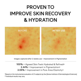 ARENCIA PDRN support Shot Serum application demonstration