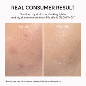 ARENCIA TXA support Shot Serum application on face