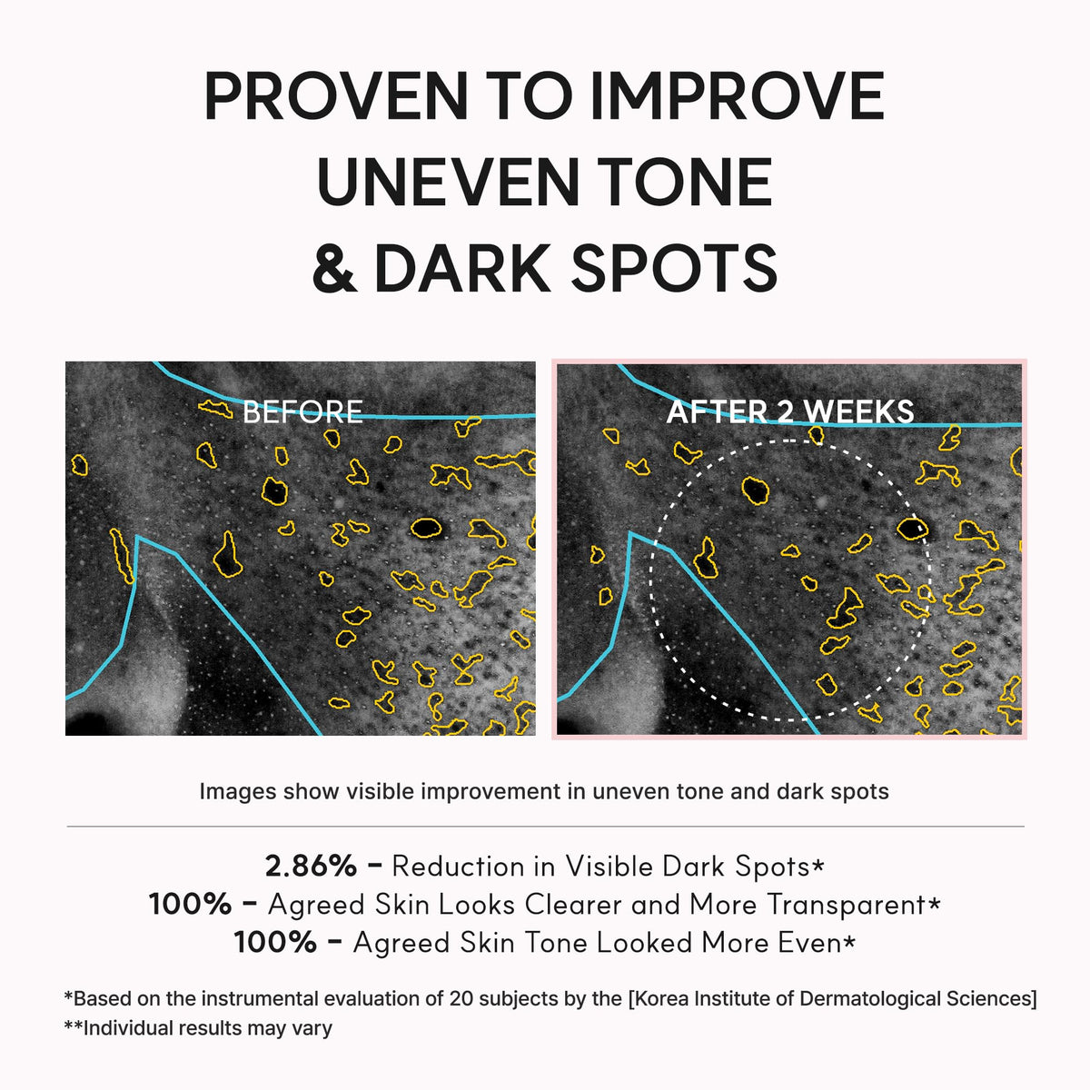 ARENCIA TXA support Shot Serum lifestyle scene