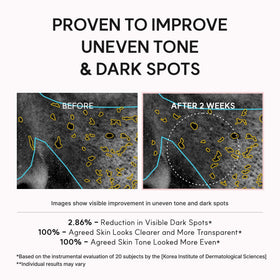 ARENCIA TXA support Shot Serum lifestyle scene