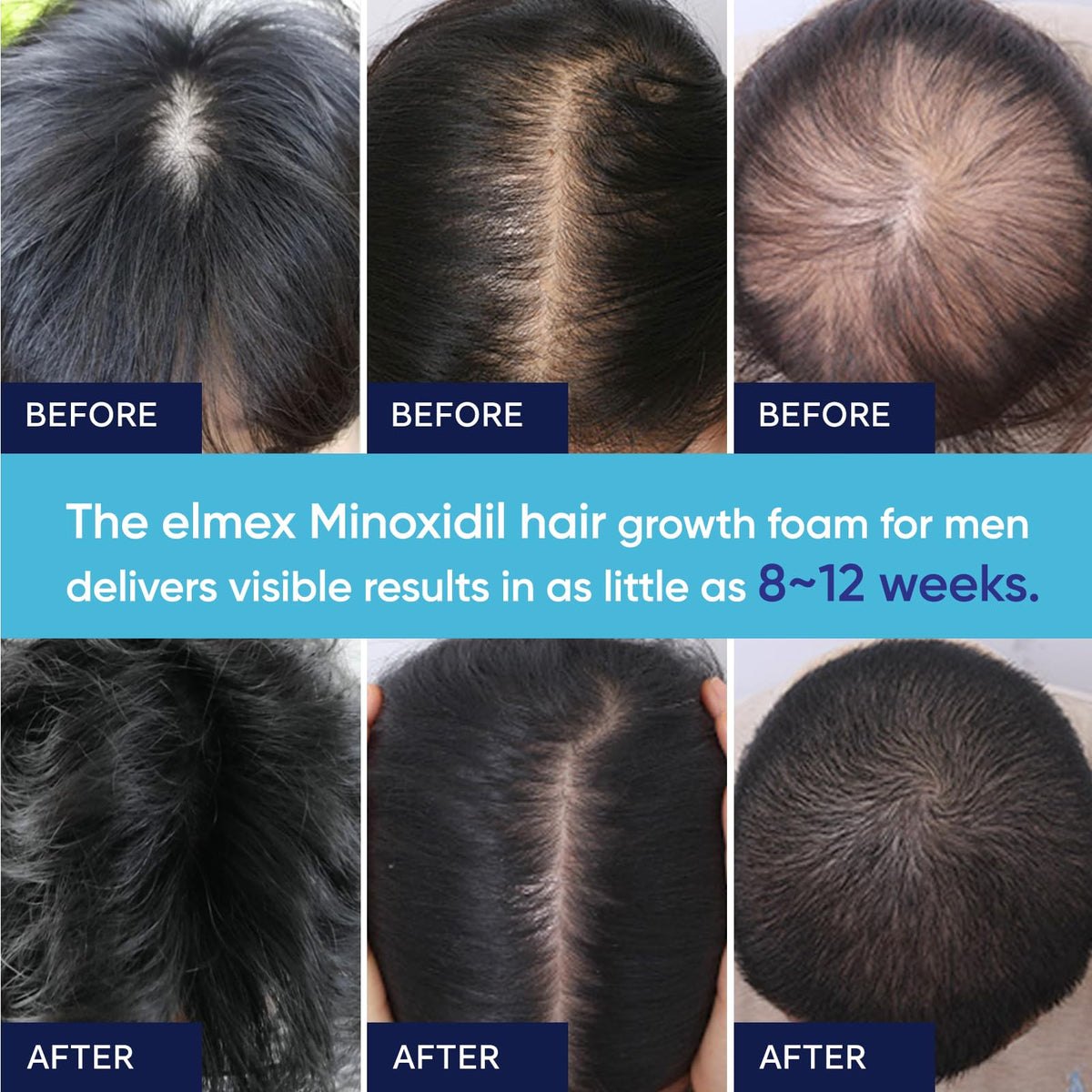 Artimore Minoxidil Foam travel-friendly compact bottle