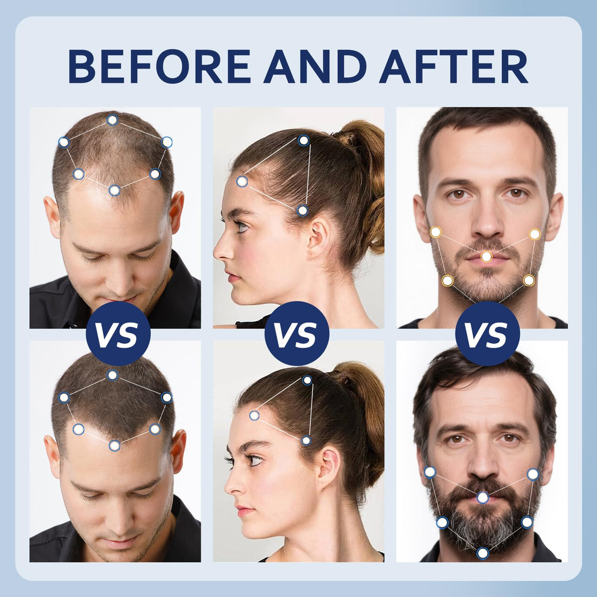 Artimore Minoxidil Hair Growth Serum 5% application on hair