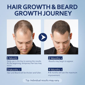 Artimore Minoxidil Hair Growth Serum 5% bottle with ingredients