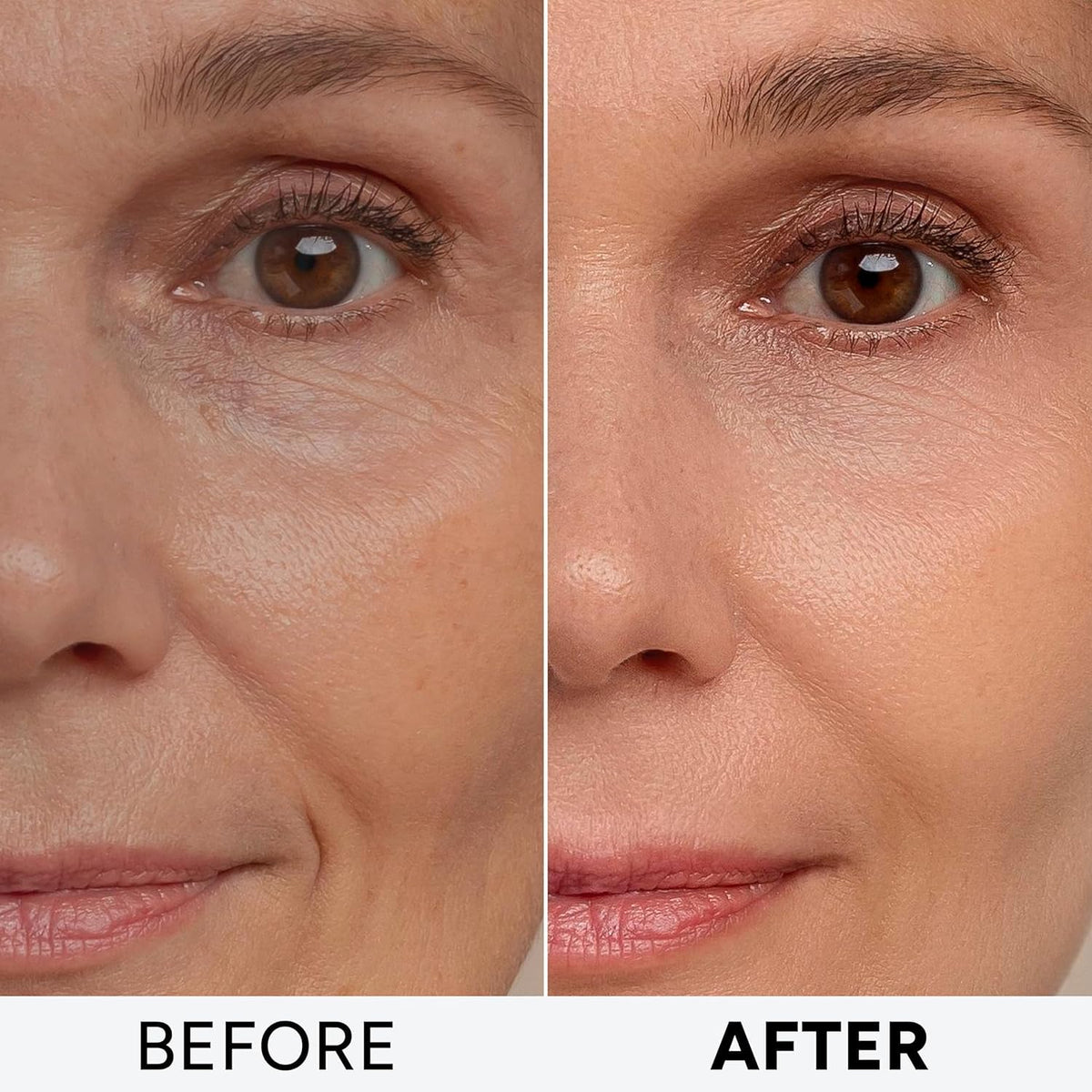 Arvesa Retinol Cream side view with cap