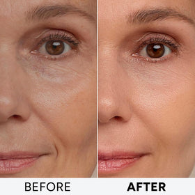 Arvesa Retinol Cream side view with cap