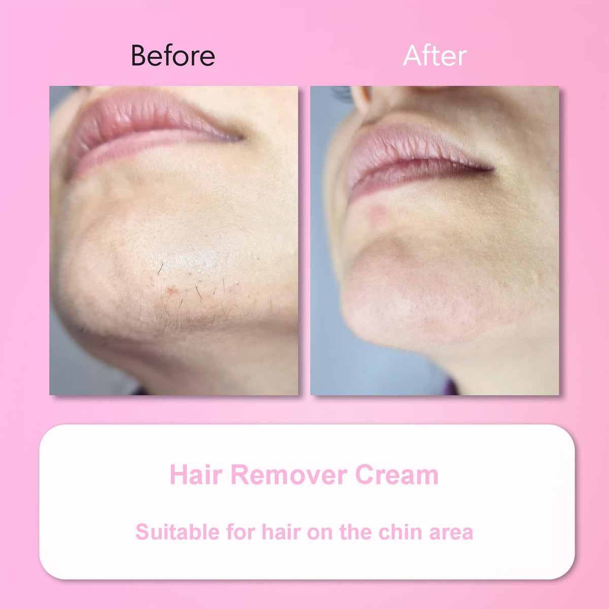 Aurlux Hair Remover Cream set displayed with all components