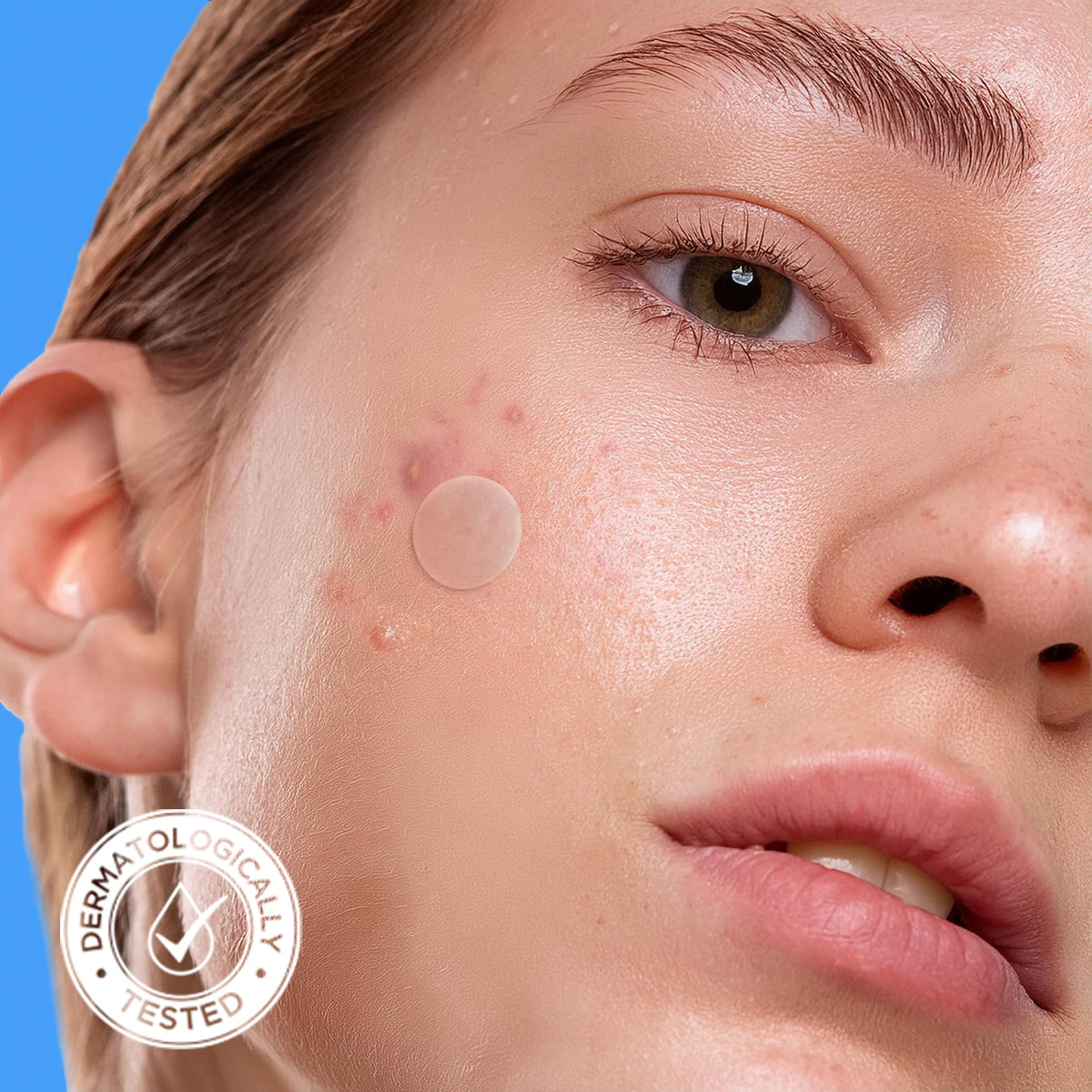 AVARELLE Hydrocolloid Acne Cover Patches showing individual patches